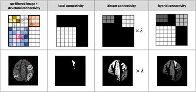 CONN-NLM: A Novel CONNectome-Based Non-local Means Filter for PET-MRI Denoising